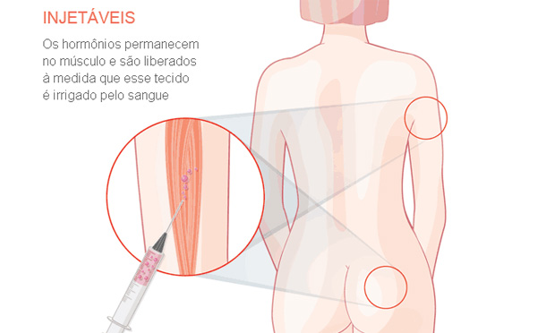 Injetáveis Injetáveis