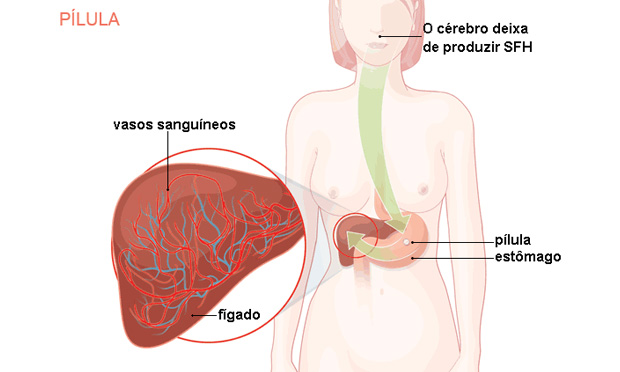 Pílula anticoncepcional