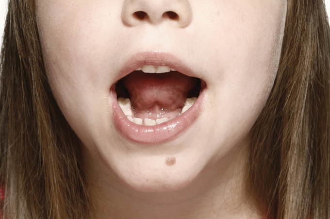 Atraso no desenvolvimento da fala: quando se preocupar