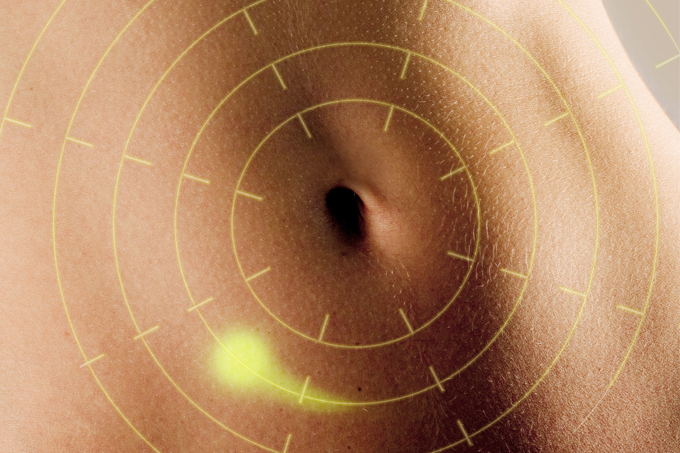 Como enfrentar a doença de Crohn e a retocolite ulcerativa