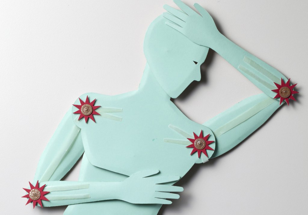 Novo dispositivo aprovado nos EUA tem ação inovadora contra artrite