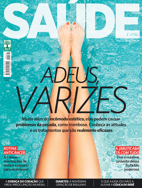 Atitudes e tratamentos contra as varizes - 01/11/2018
