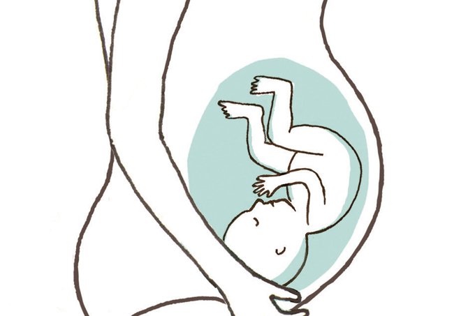 Periodontite em gestantes dobraria o risco de parto prematuro