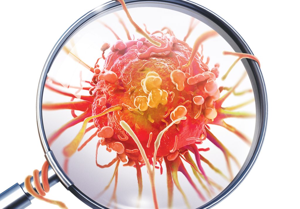 Zika inibe multiplicação de células do câncer de próstata