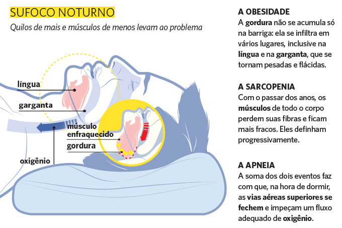 Sufoco noturno. Sufoco noturno.