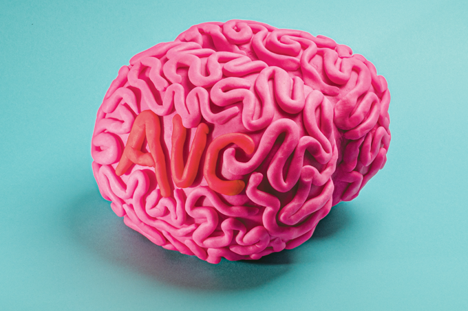 A evolução dos tratamentos para AVC nos últimos 20 anos