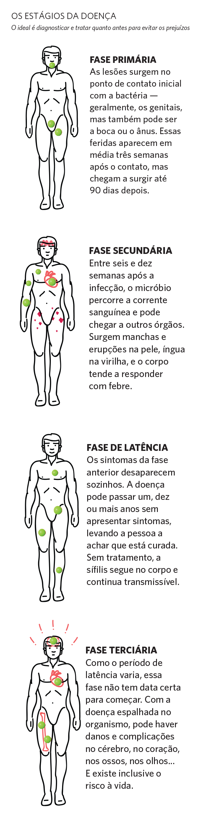 Os estágios da sífilis. Os estágios da sífilis.