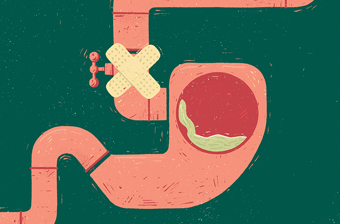 Refluxo tem conserto