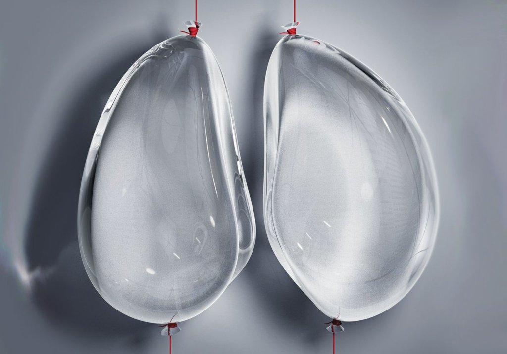 Asma protegeria contra o agravamento da Covid-19, sugere estudo