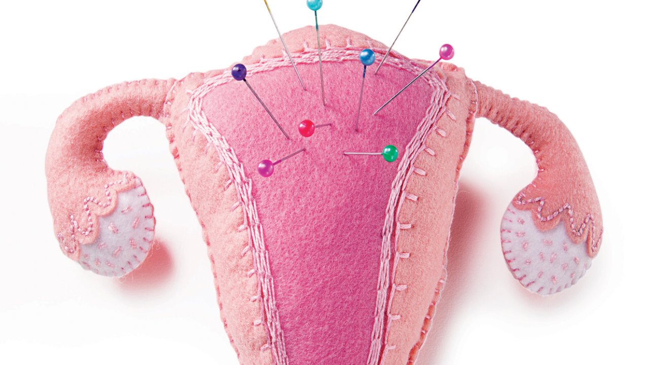 endometriose-utero