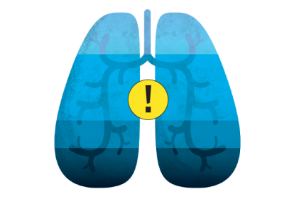 Desenho de pulmões azuis com ponto de exclamação no meio
