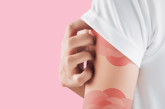 Pele e emoções: como sentimentos afetam sua saúde cutânea