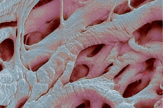 Imagem de microscopia eletrônica exibe estrutura interna do coração.