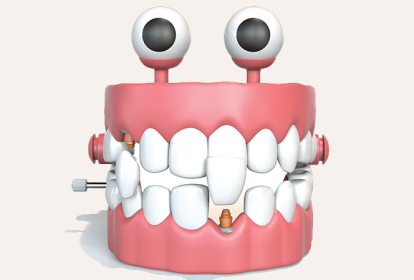 imagem de boca em 3D com um implante dentário