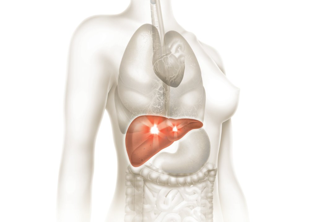Hepatites virais: não podemos deixar ninguém para trás