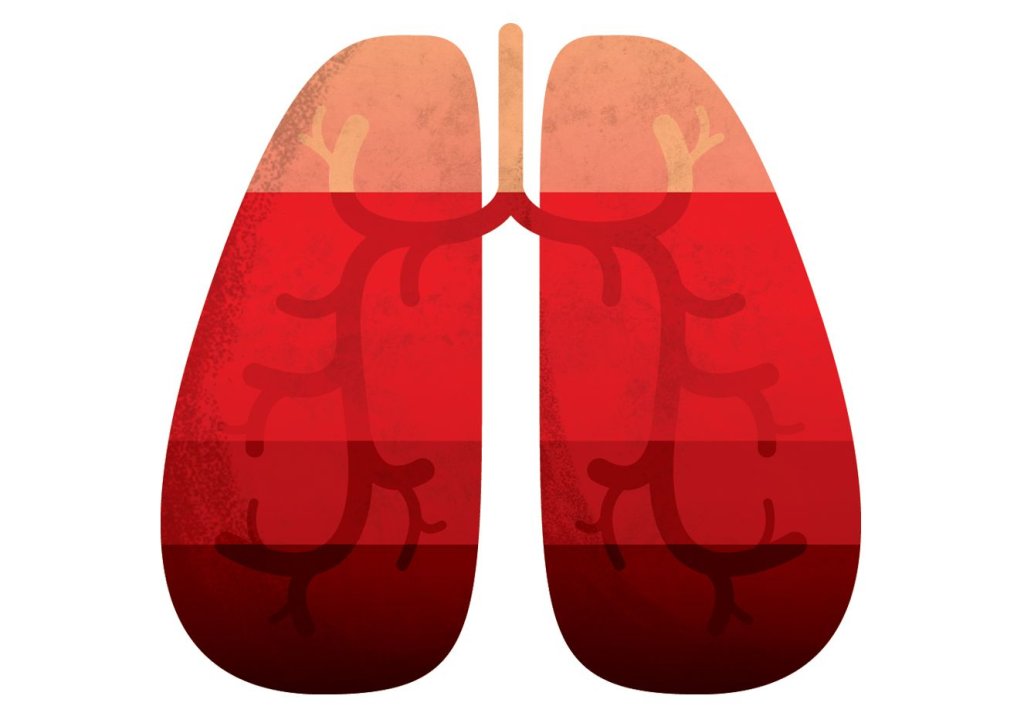 O papel da fisioterapia respiratória durante e depois da Covid-19