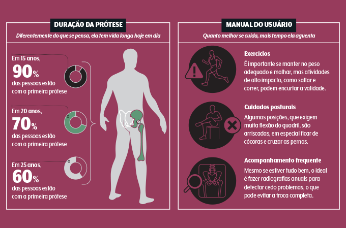 quanto tempo dura a prótese de quadril