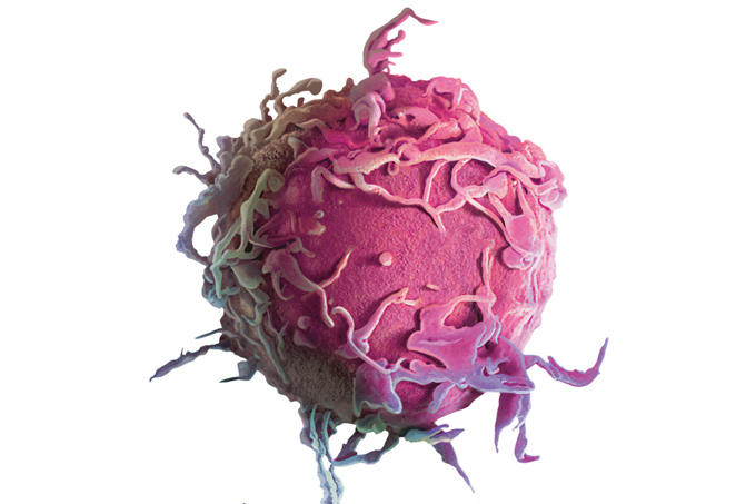 tumor na bexiga