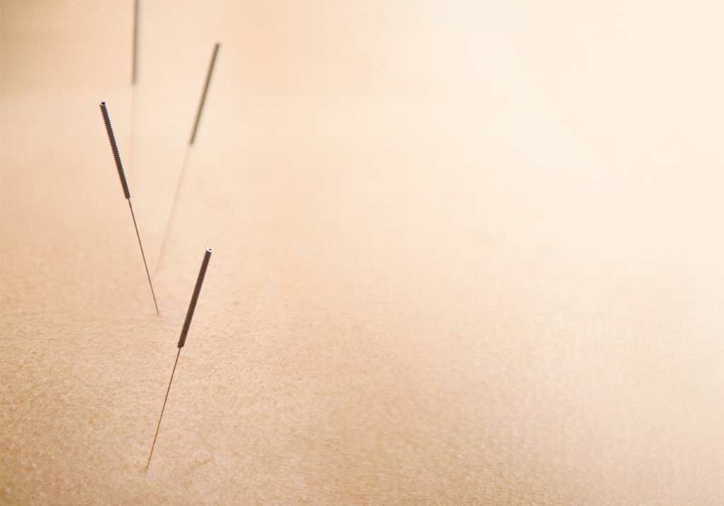 O papel da medicina integrativa na saúde mental