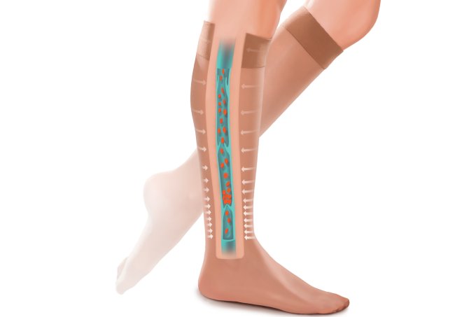 Calor: os cuidados para aliviar inchaço, peso e varizes nas pernas