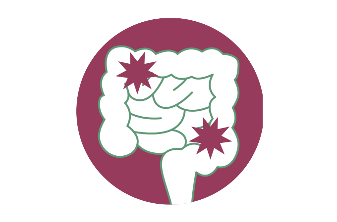 Doenças inflamatórias intestinais: quanto antes se descobre, melhor!