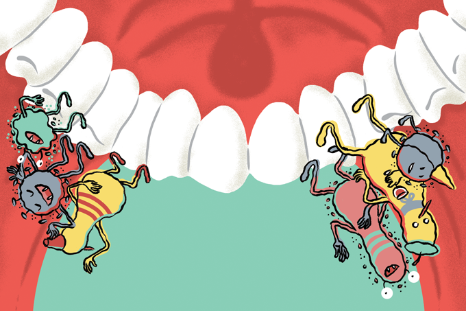 Gengivite e periodontite: um bate-boca dentro do corpo