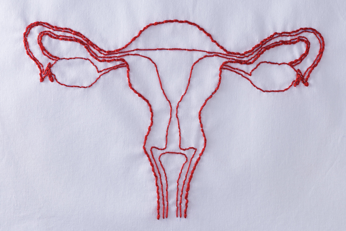 esterilização pelo SUS