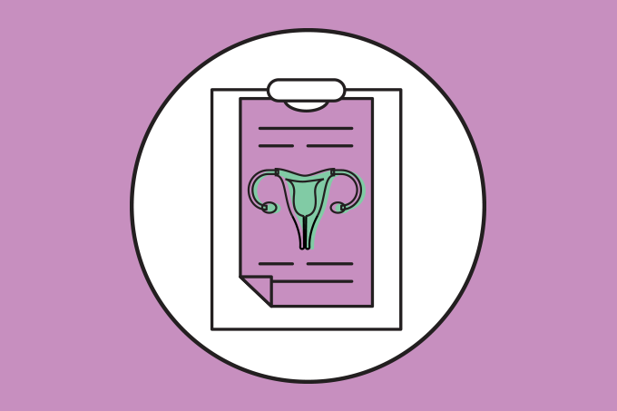 cid endometriose cid da endometriose