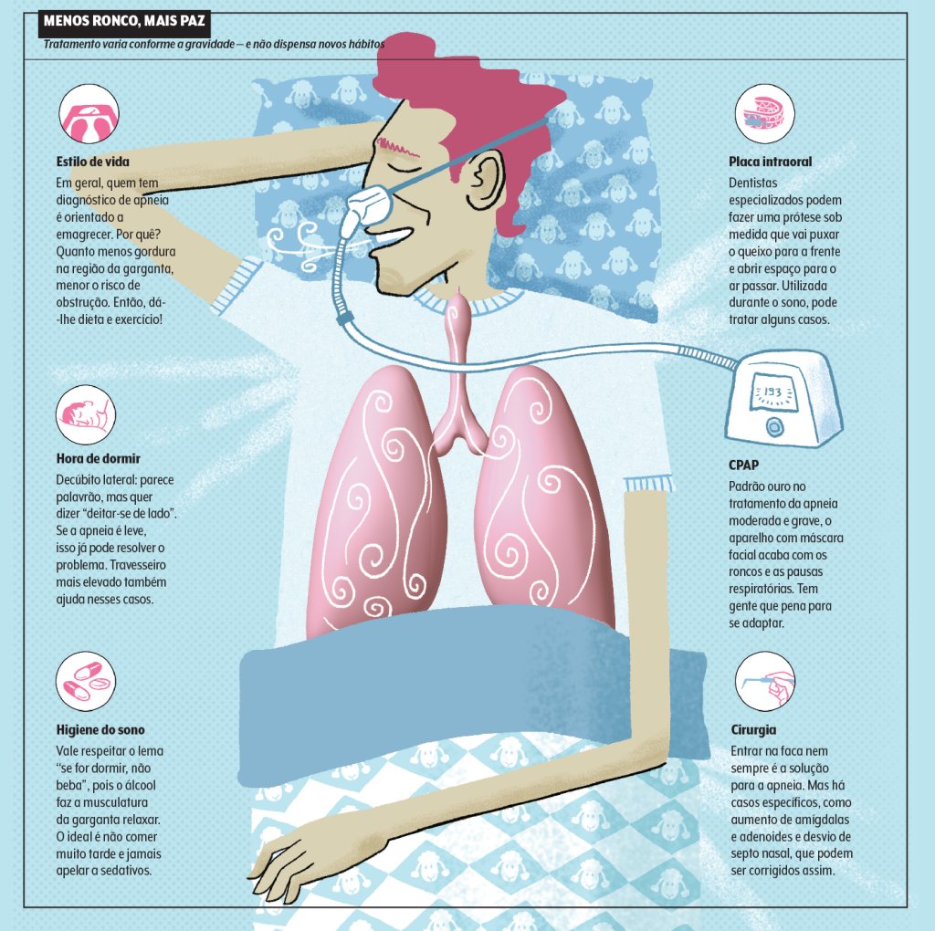 Apneia do Sono: soluções