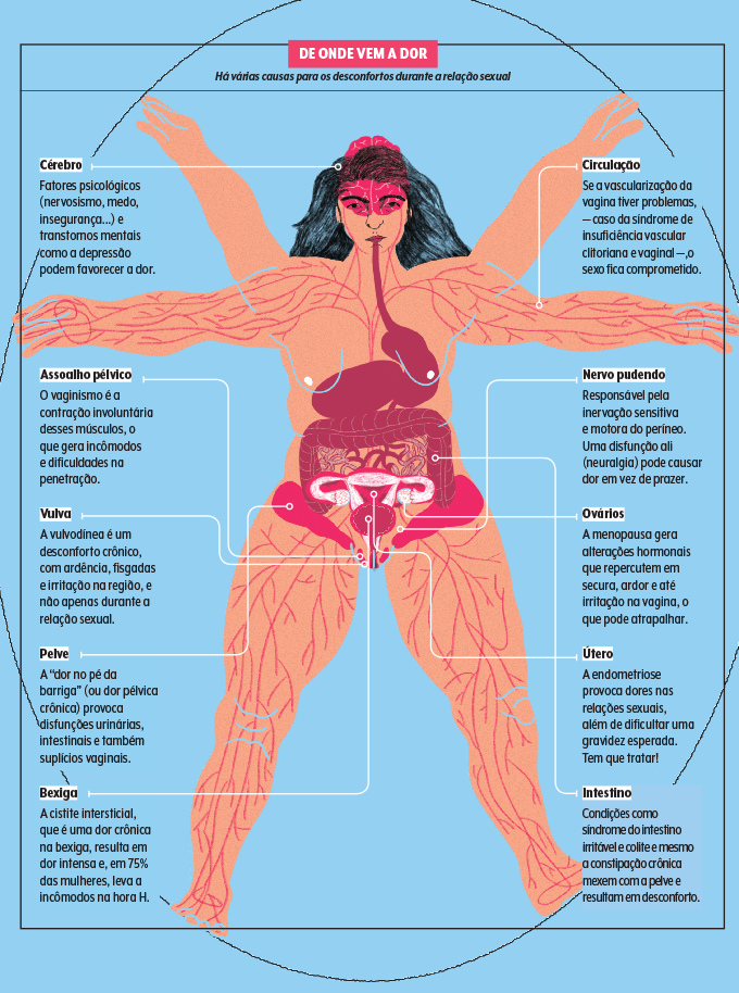 saude-intima-mapa-da-dor-na-relacao-sexual mapa da despaurenia