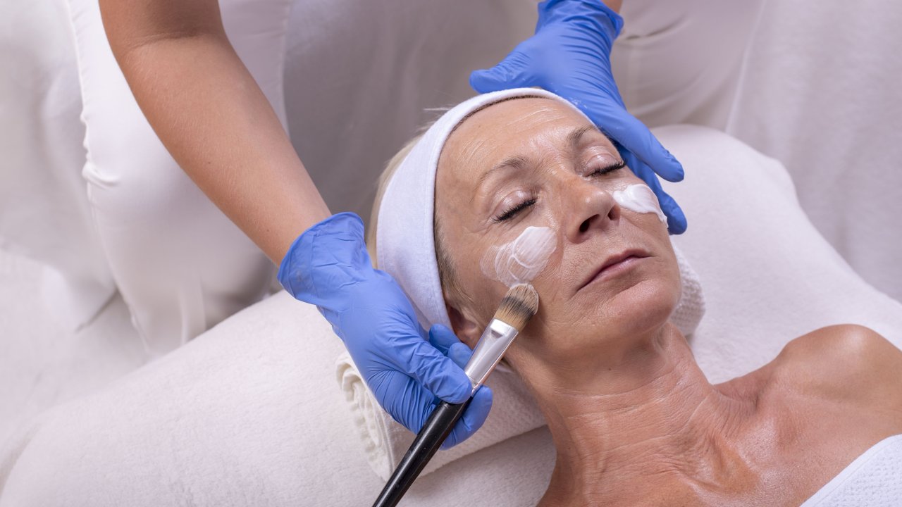 peeling-de-fenol