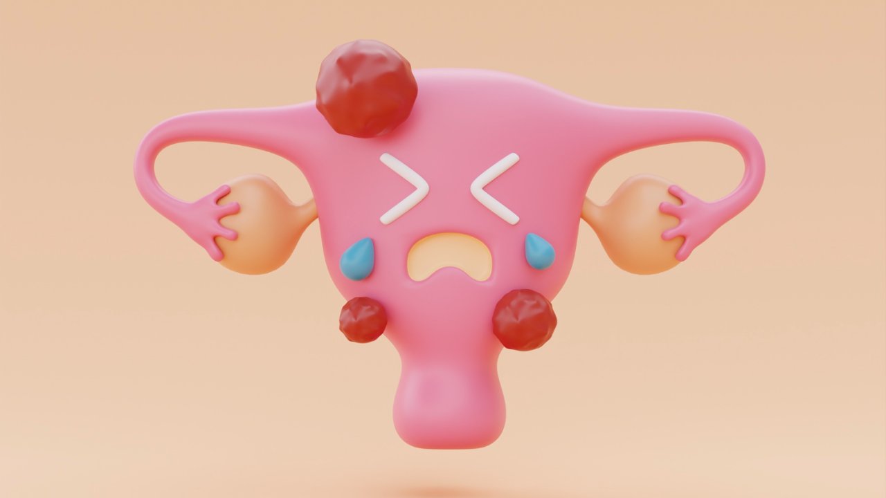 mioma-utero-desenho