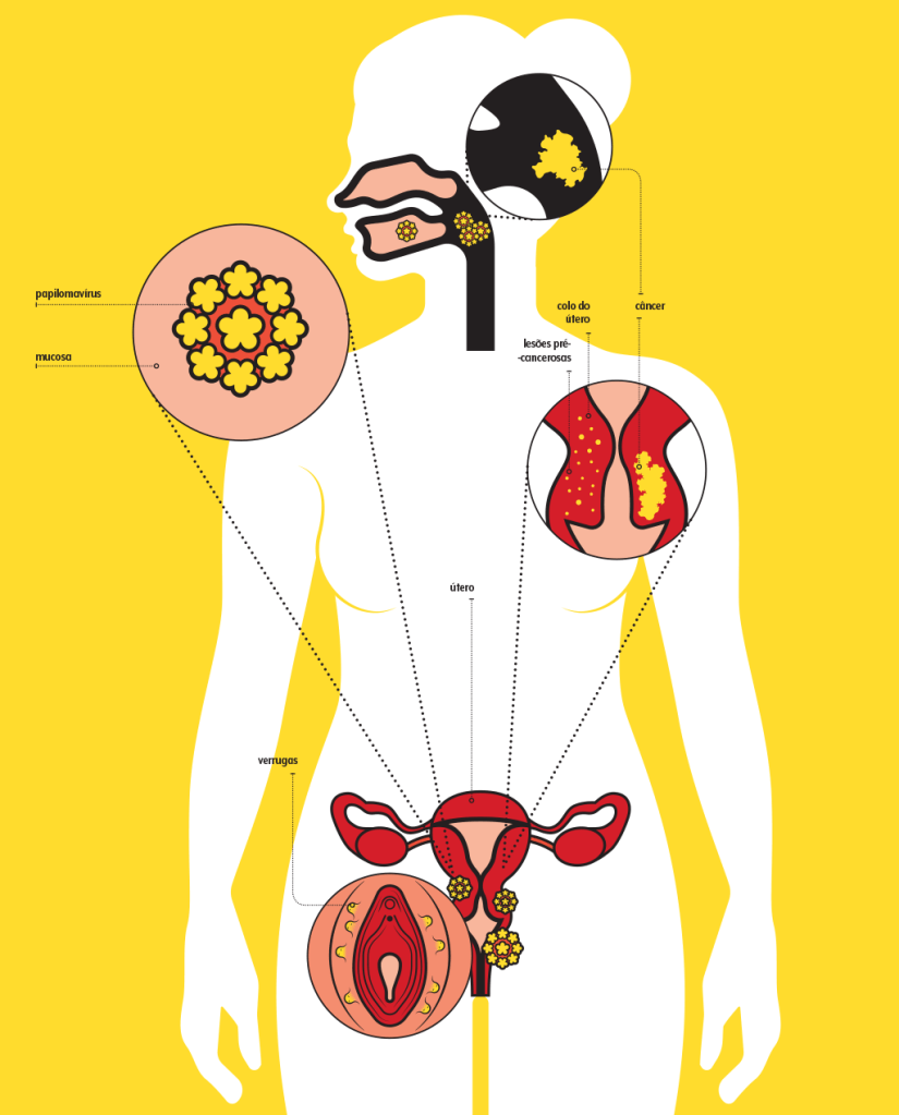 vacina-hpv-info