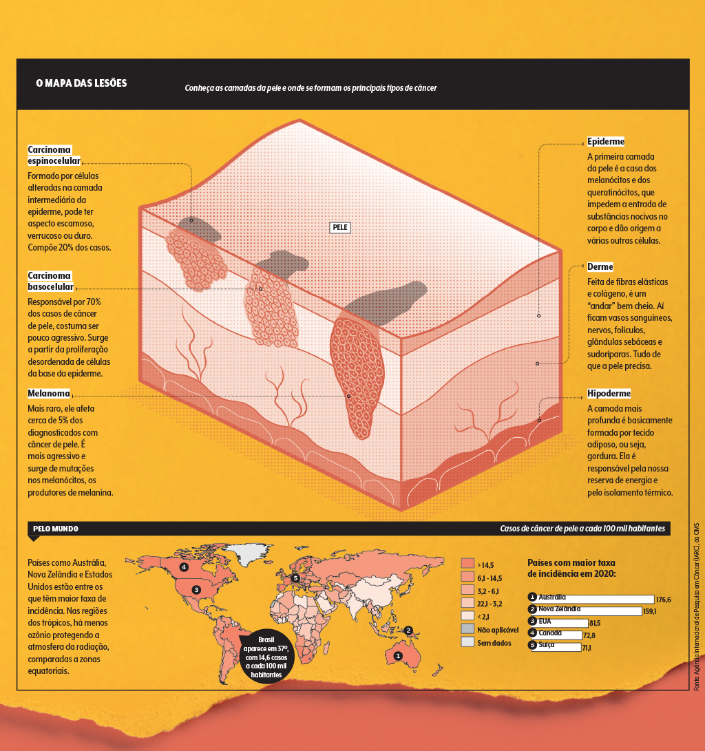 câncer-pele-tipos