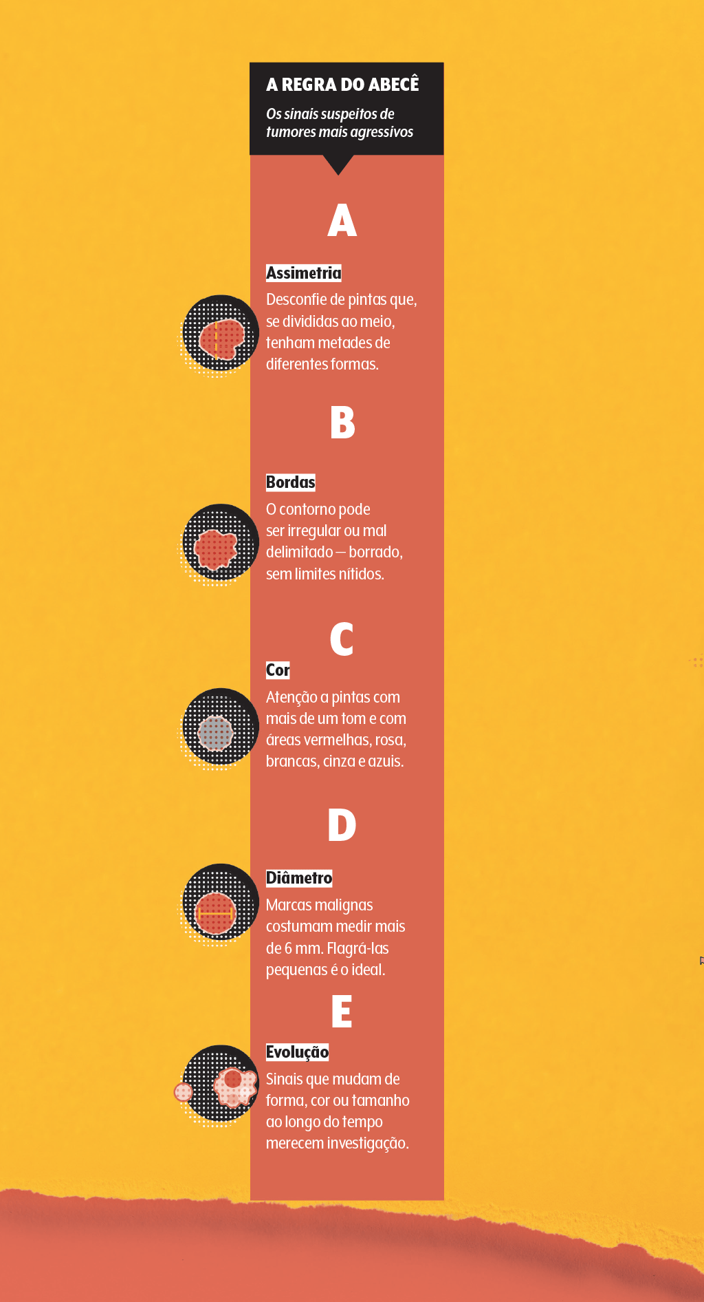 melanoma-diagnóstico-abcde