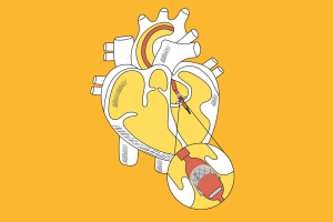 coracao-estenose-aortica