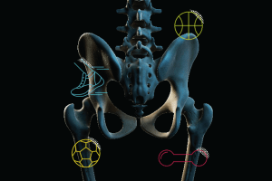 osteoporose-como-evitar