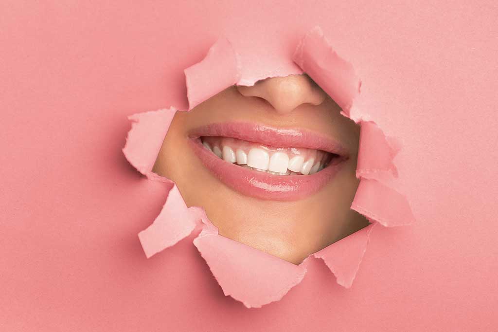 Qual a relação entre a cor do dente e a saúde bucal?