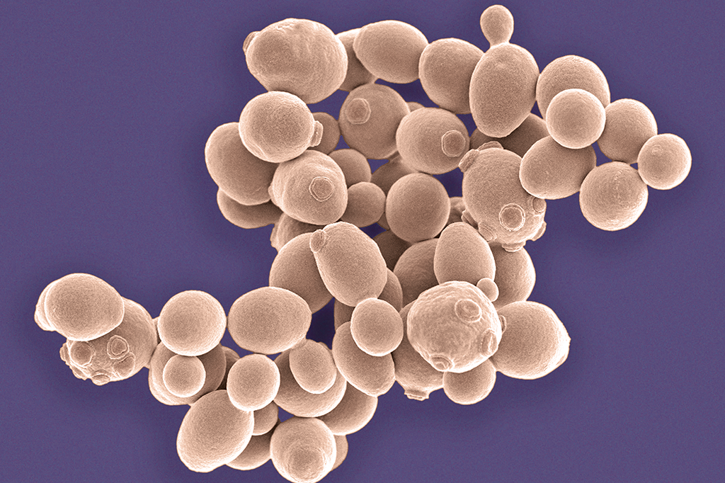 Zoom: vai rolar a festa