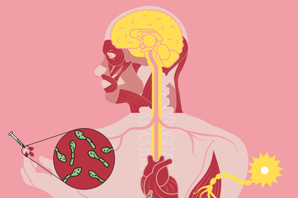 Tétano: por que é crítico se prevenir e tomar a vacina?