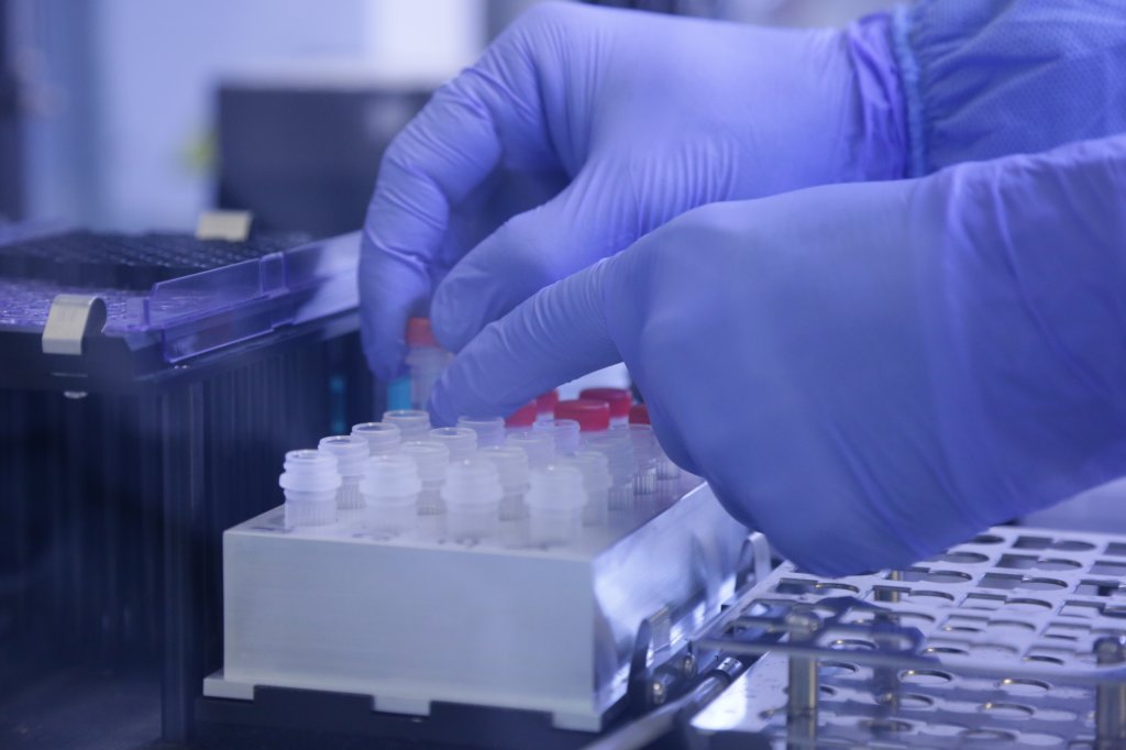 Gripe aviária: o que sabemos sobre o primeiro caso humano de H5N2