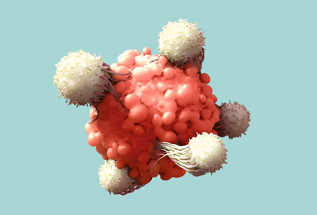 Câncer: quando o conhecimento se converte em cura