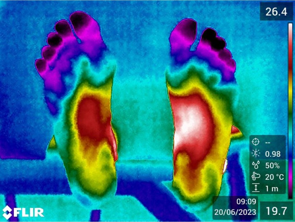 Termografia ajuda a prevenir lesões de atletas olímpicos e amadores