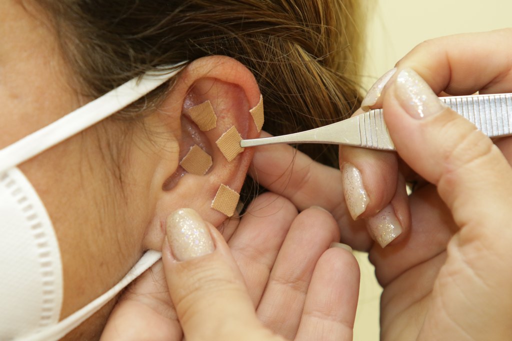 Auriculoterapia faz bem? Faltam provas robustas disso