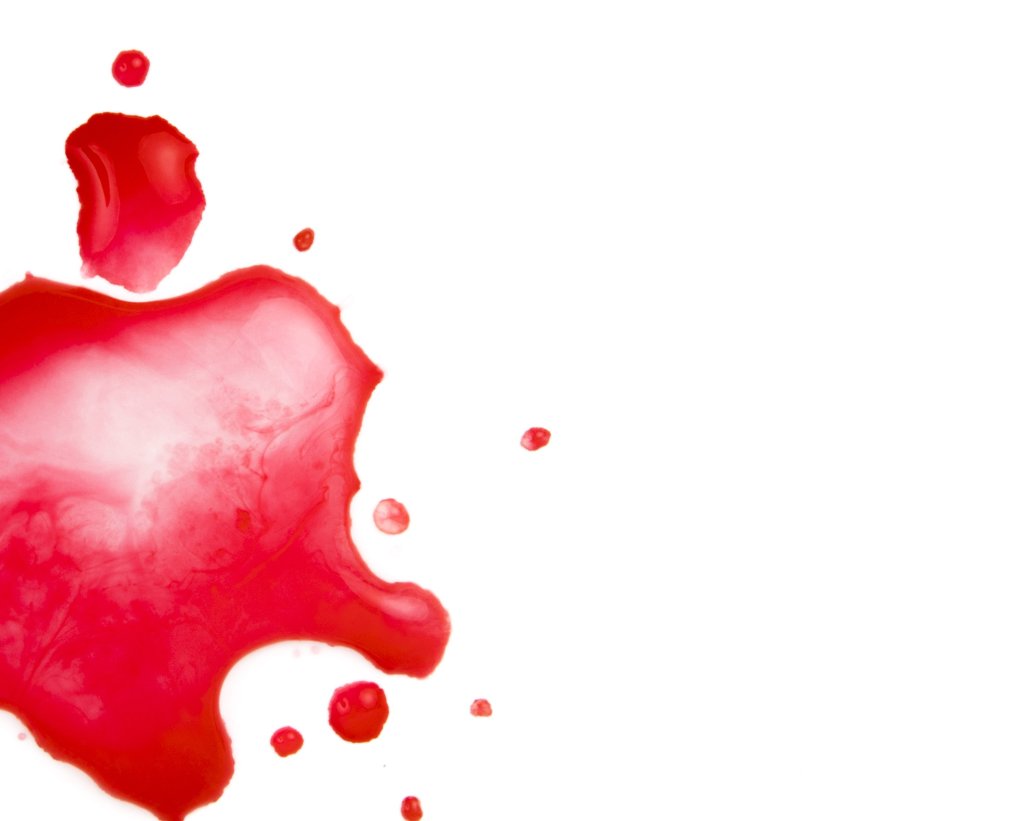 Hemofilia: saiba o que é, quais as causas e sintomas