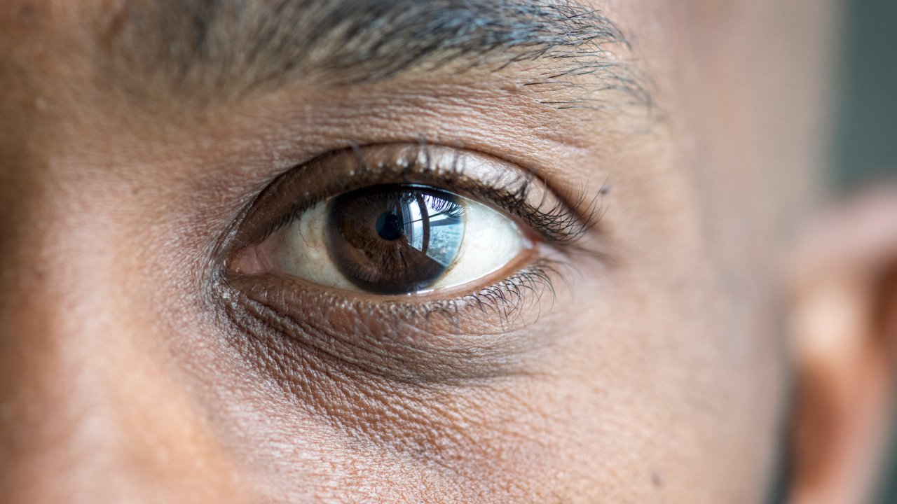cornea