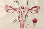 miomas-utero