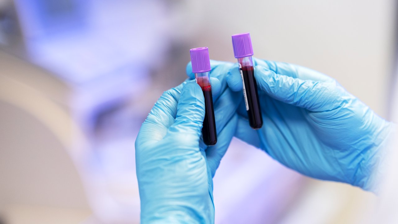 exame-sangue-eritrocitos