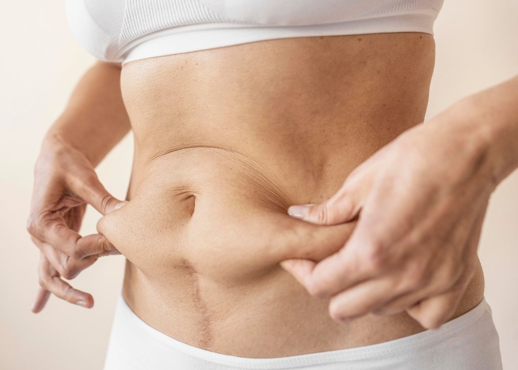 4 perigos da gordura abdominal para a saúde (e o que fazer para eliminá-la)