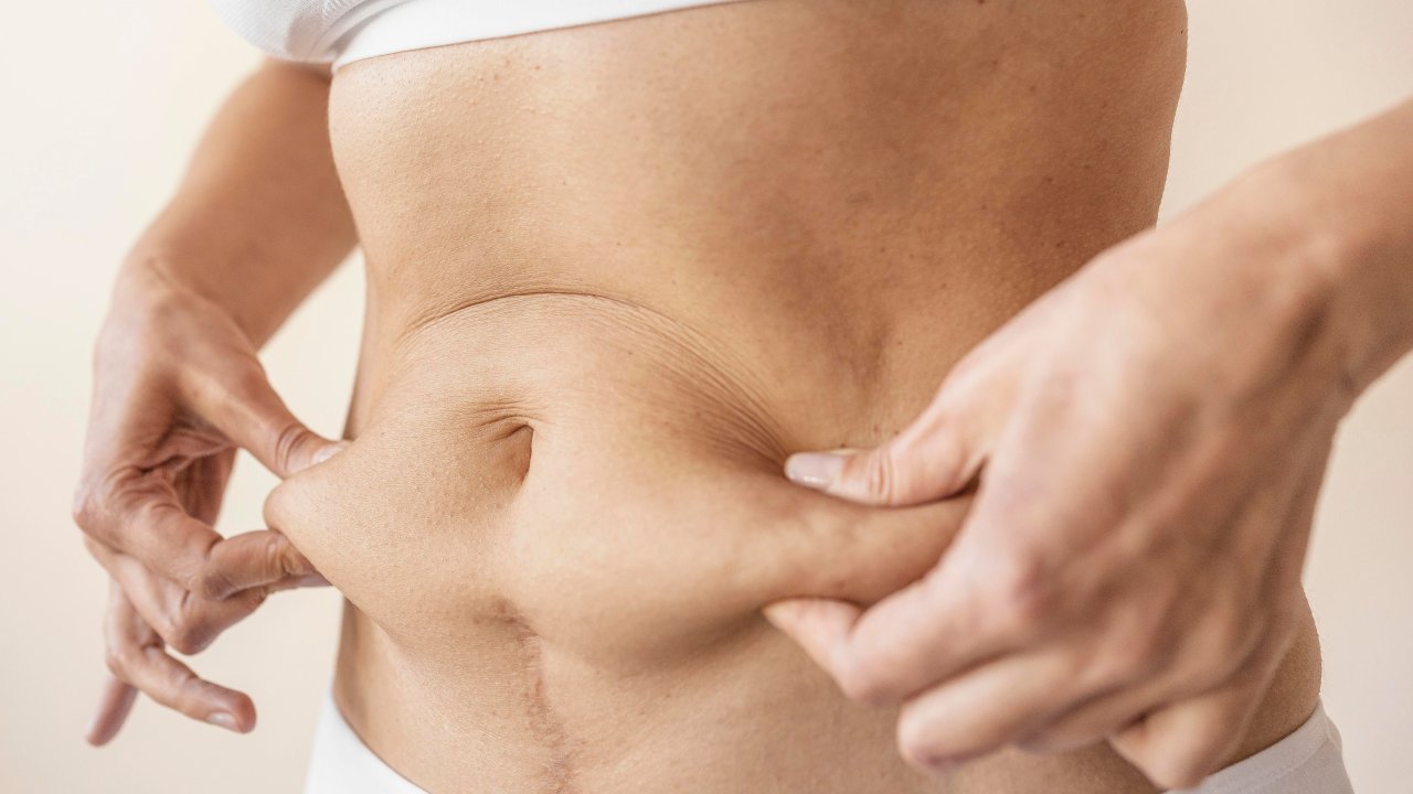 gordura-abdominal-como-perder